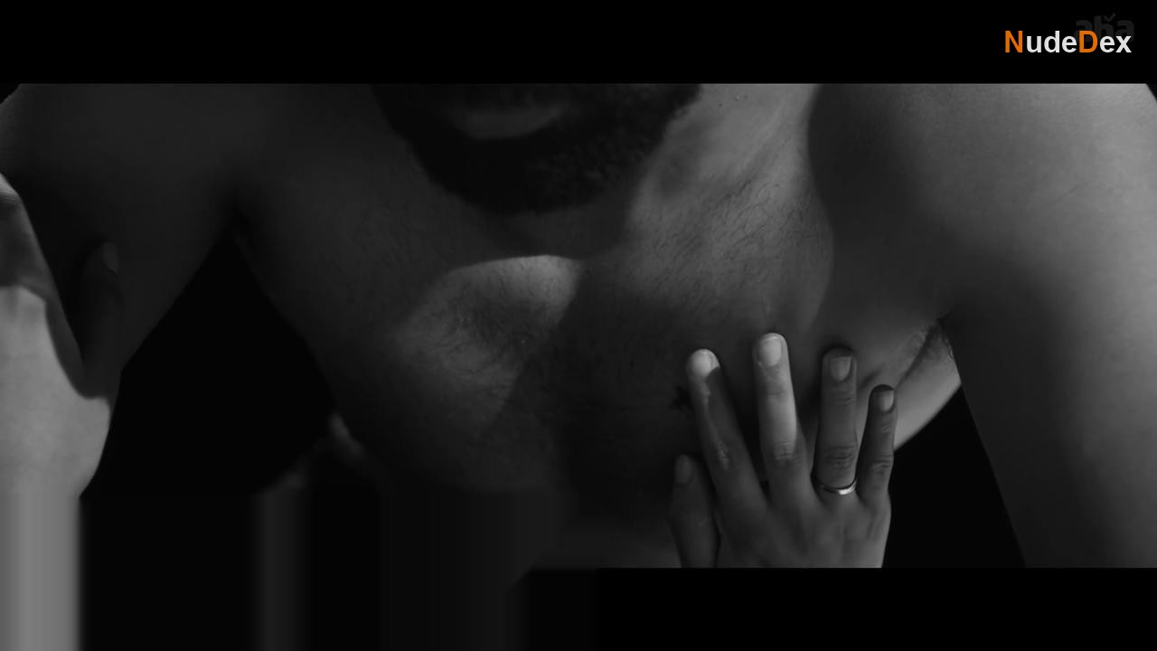 Birthmark in Birthmark, photo 9