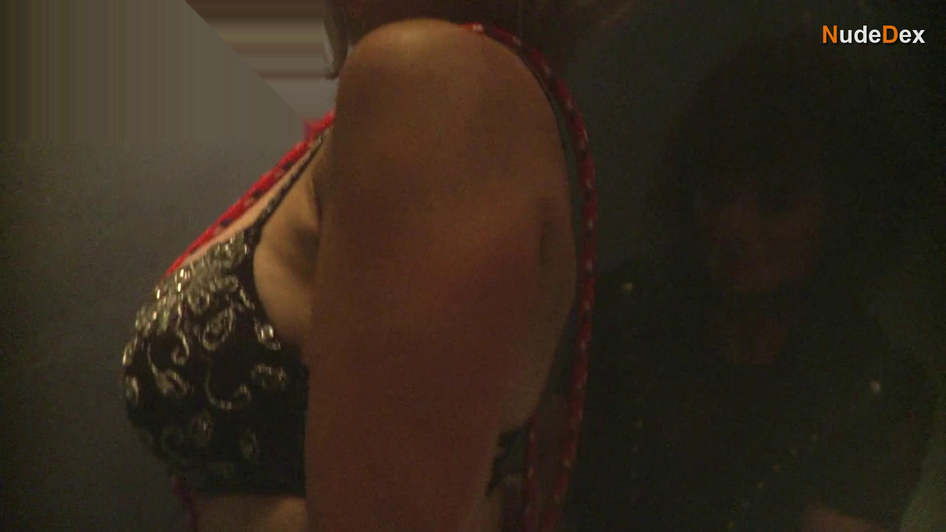 Wound in Wound, photo 2